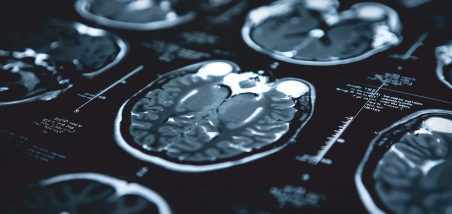 Two New Types ,types of MS